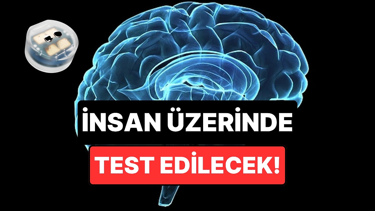 Depresyon Tedavisinde Devrim: Beyin İmplantı İnsanlarda Denenecek